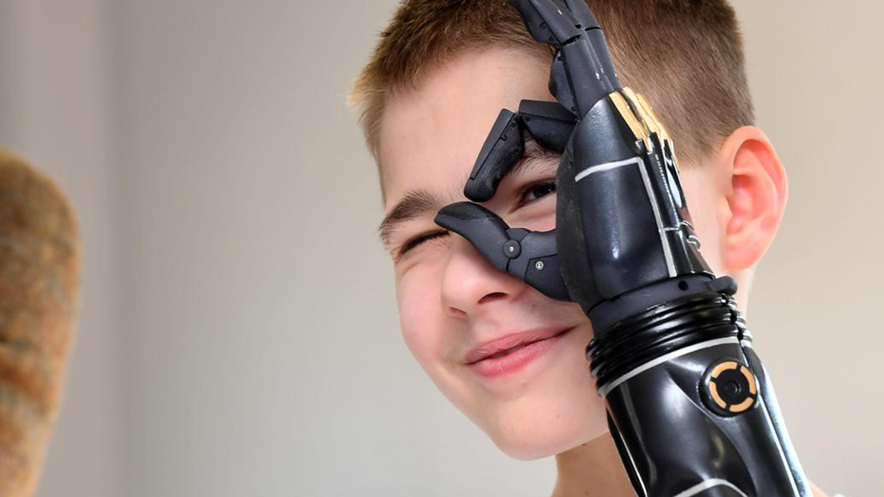 A young boy with a cutting edge bionic arm.