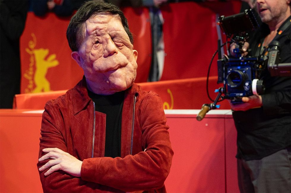 Actor Adam Pearson at the 74nd Berlin International Film Festival