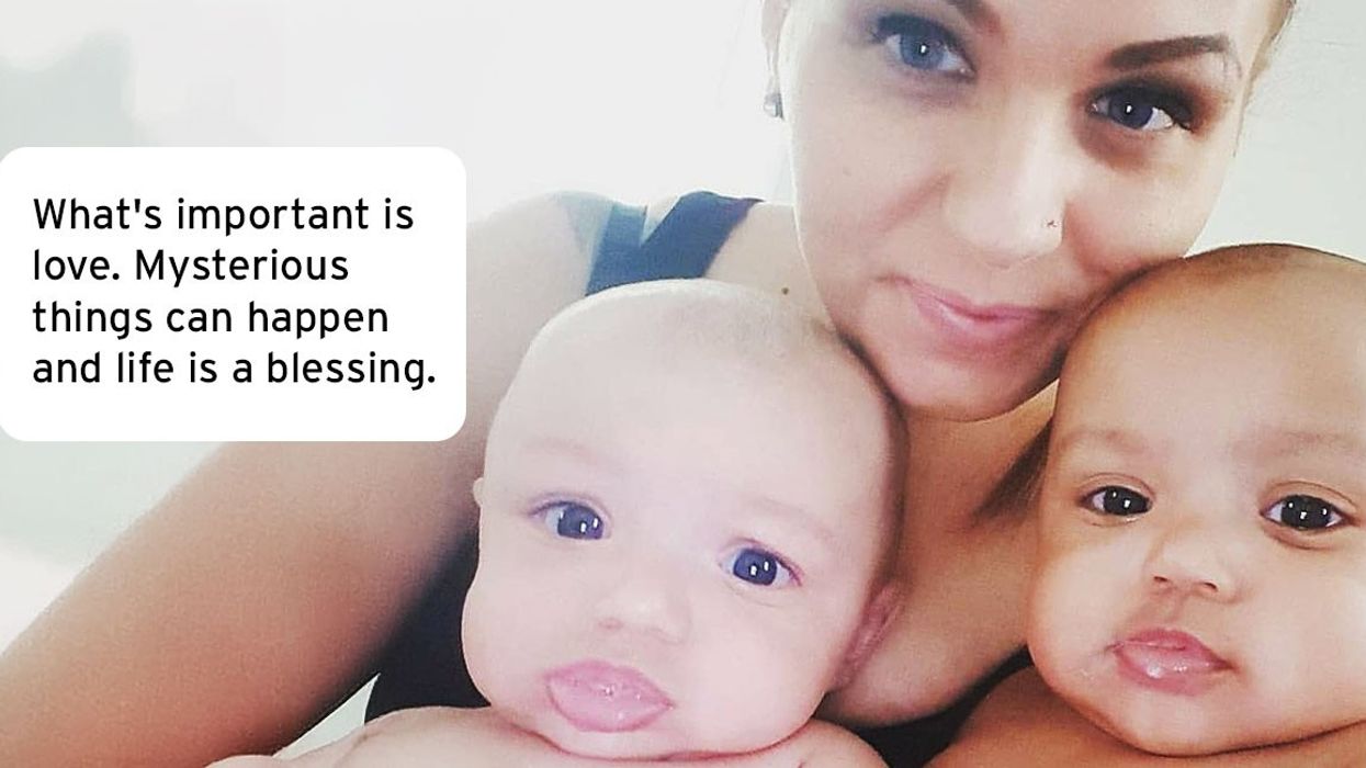 Rare twins with different skin tones show beauty in diversity