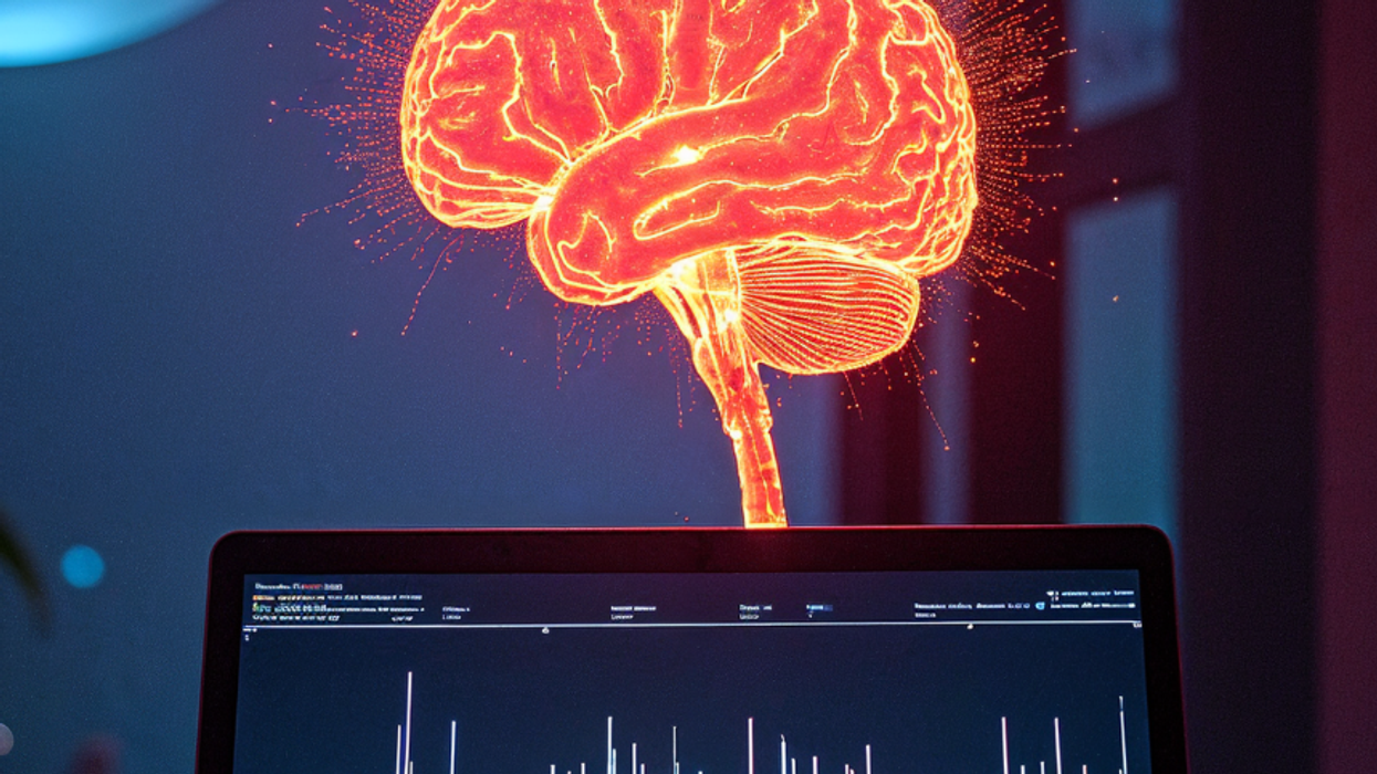 Scientists extracted a Pink Floyd song from brainwaves and it’s haunting